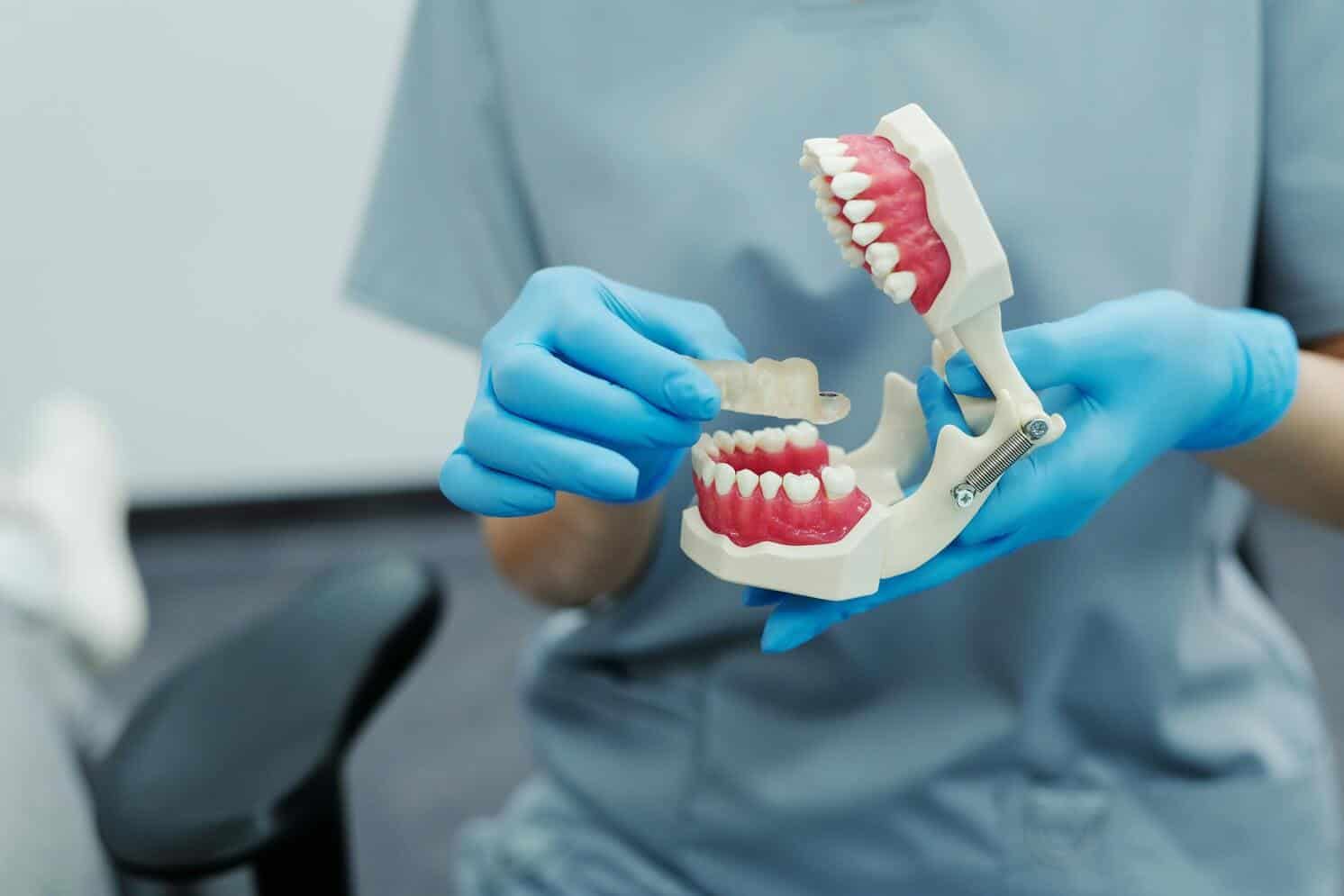 Desgaste dental: conoce sus causas, tipos y cómo tratarlo
